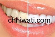 وصفة الدكتور جمال الصقلي للتخلص من إصفرار الأسنان